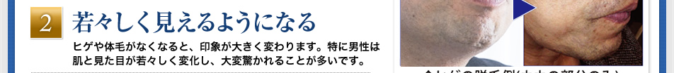 「若々しく見えるようになる」ヒゲや体毛がなくなると、印象が大きく変わります。特に男性は肌と見た目が若々しく変化し、大変驚かれることが多いです。